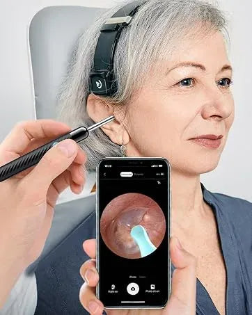 Lebanora™ – Caméra Intelligente de Nettoyage des Oreilles