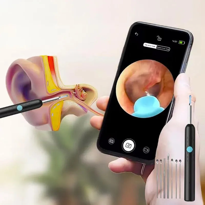 Lebanora™ – Caméra Intelligente de Nettoyage des Oreilles