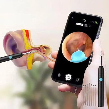 Lebanora™ – Caméra Intelligente de Nettoyage des Oreilles
